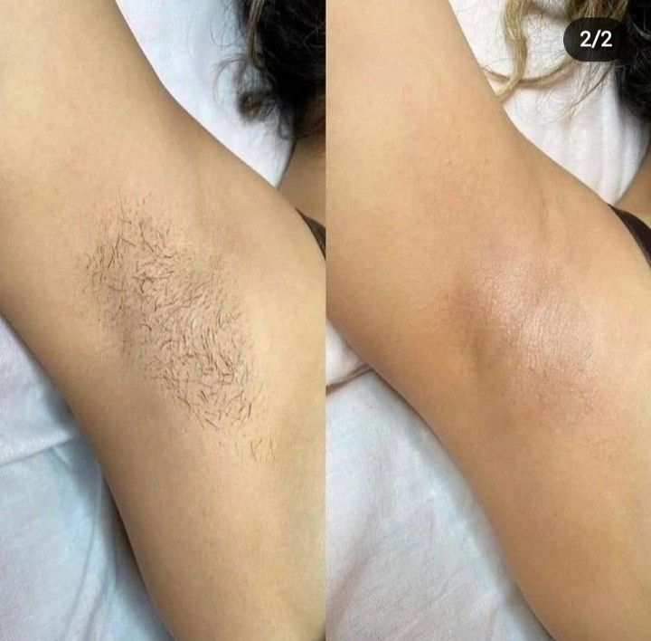 Underarms · Week 0 → Week 12